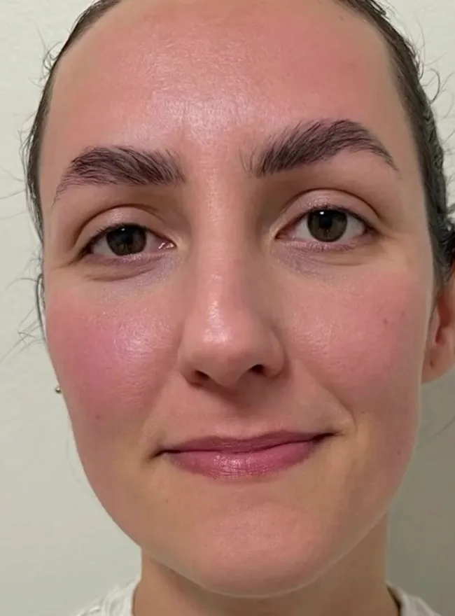 After: even, glowing skin