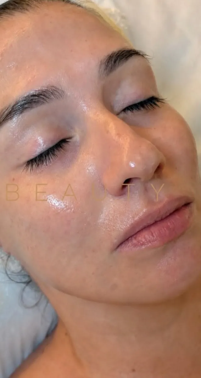 After — Clearer, brighter skin